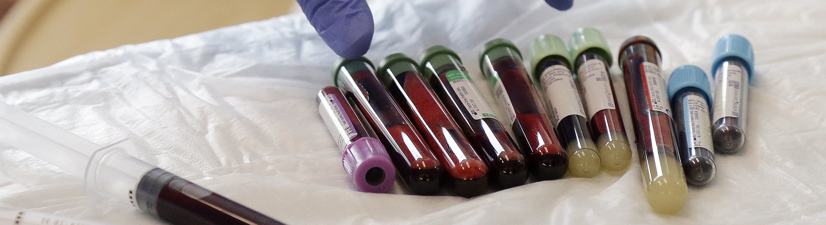 Tratamento revolucionário de modificação genética aprovado nos EUA