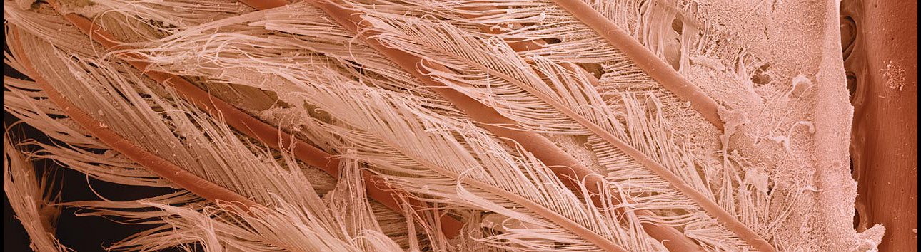 17 Alimentos que são espantosos ao microscópio